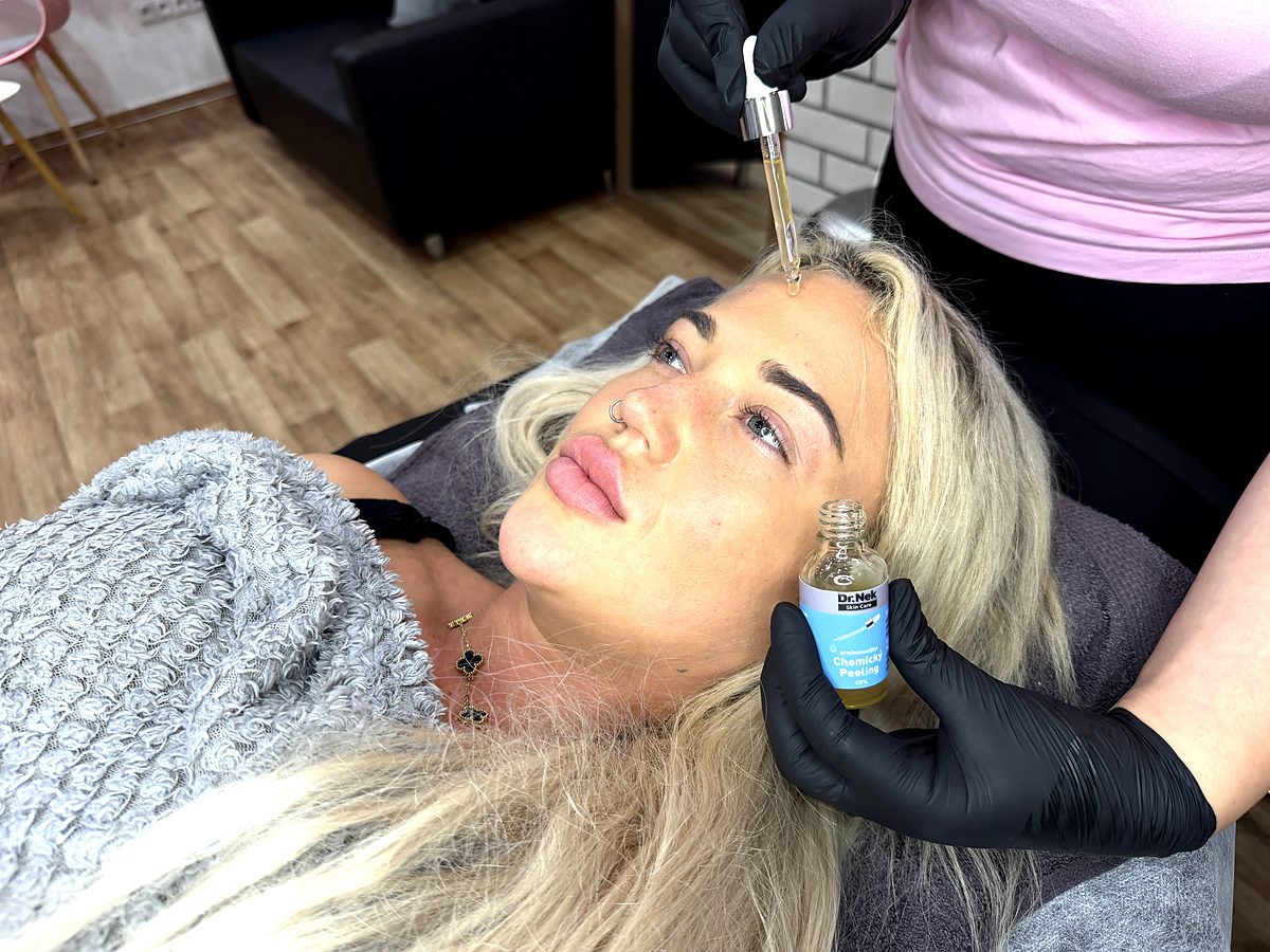 Curs online de peeling chimic