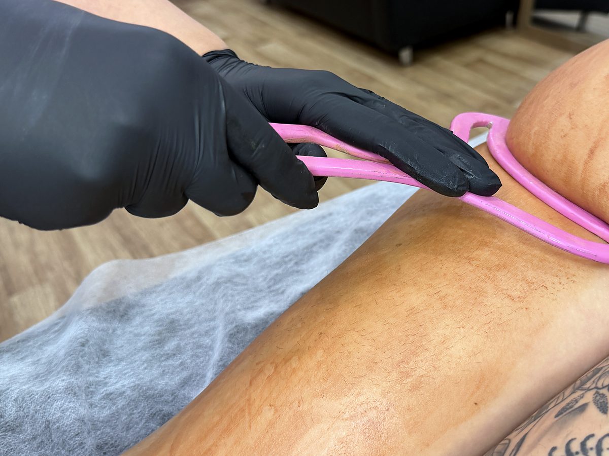Curs online Ice Metal Therapy